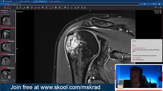 Shoulder MRI Focus Sessions - LIVE screenshot 4