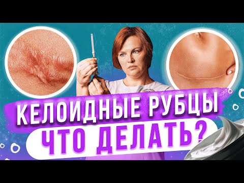 Келоидные рубцы. Что точно не стоит делать?