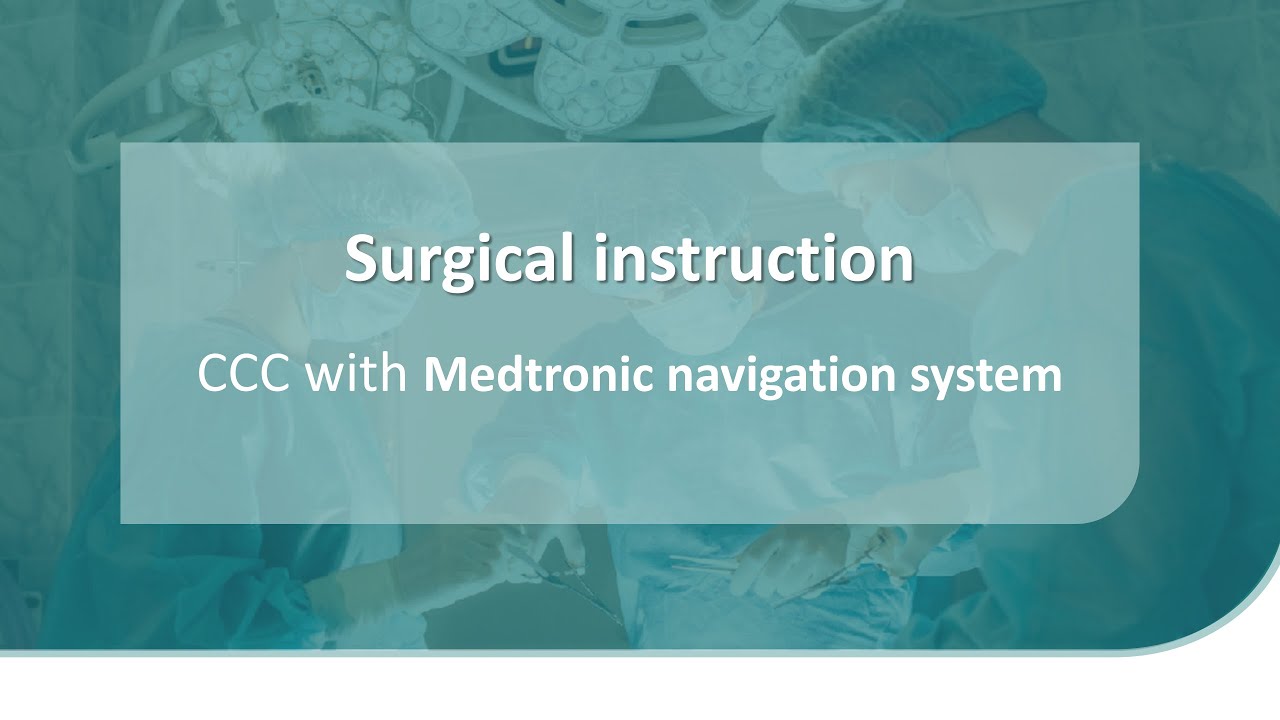 Surgical instruction - CCC with Medtronic navigation system - YouTube
