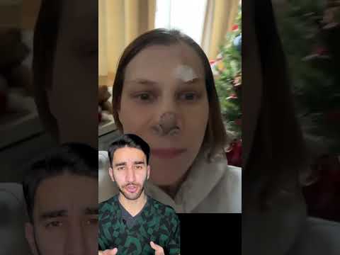 чуть не лишилась носа