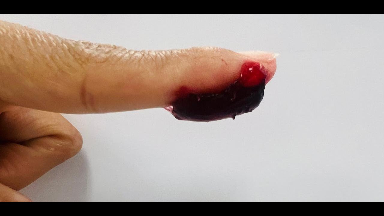 GOLD-ENHANCED HYDROGEL NANOARCHITECTURES: FUNCTIONAL MATRICES FOR BIOMEDICAL INNOVATIONS