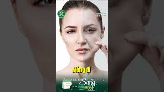 Tại sao nám của bạn không bao giờ hết? #skinfacts #beautytips #namproblem