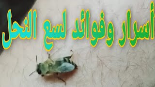 bee sting  ..amazing لسعة النحله  وفوائد لسع النحل الطبيعية للصحة العامة bee sting Bee Sting 