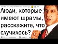 Люди со шрамами, как это случилось?