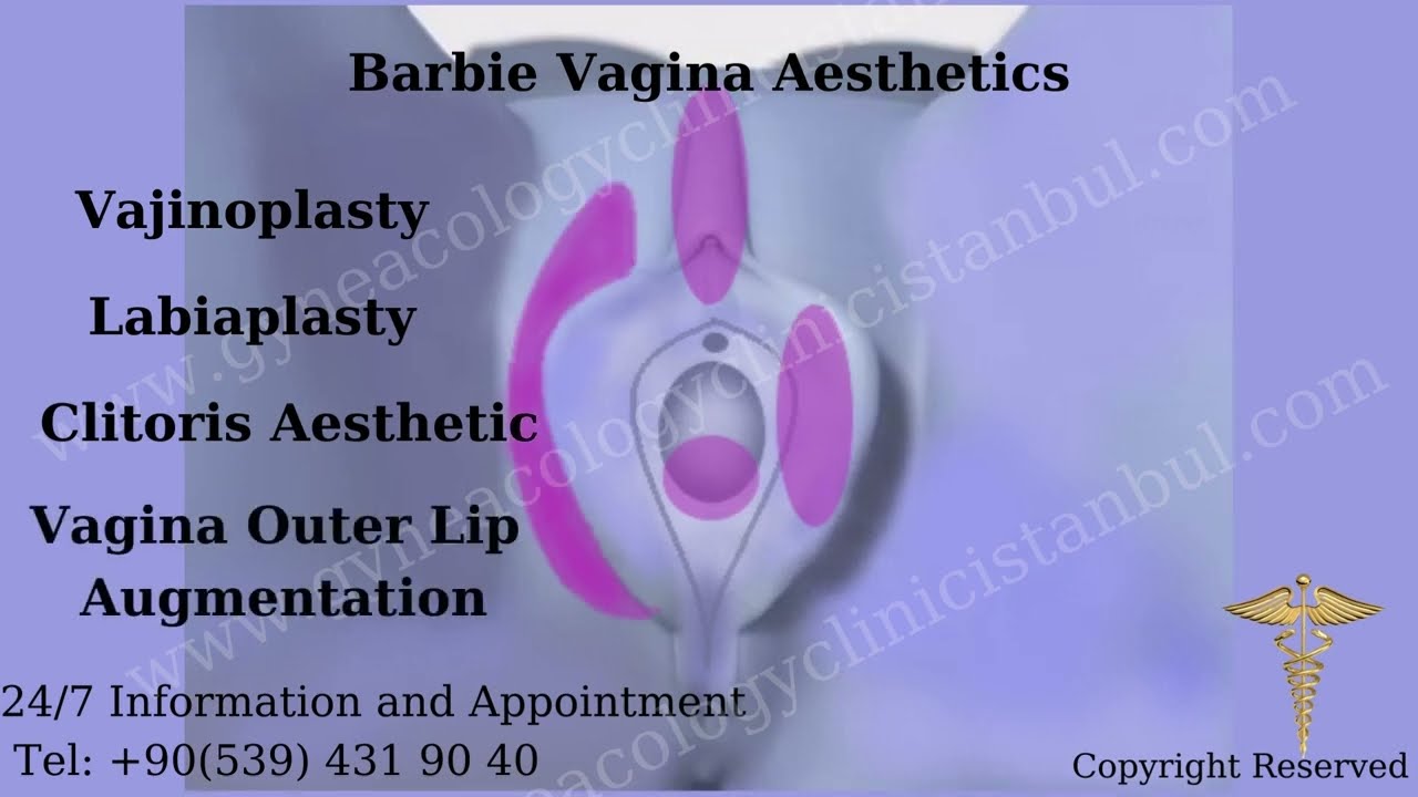 What is Barbie Vagina Aesthetics? How to do Barbie Vagina Aesthetics? -  YouTube