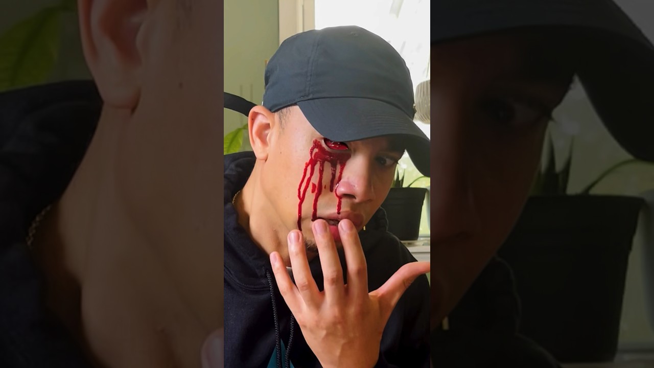 Suki Suki Daisuki Missing Eye