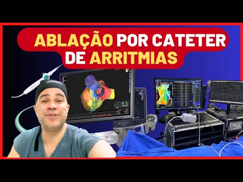 ABLAÇÃO POR CATETER