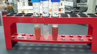 Nitrate reduction test  Results