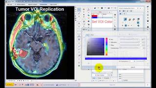 PFUS Tool for Image Registration and Fusion (Overview) Wealth