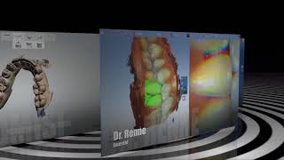 Planmeca Emerald, 3Shape Trios, Cerec Omnicam
