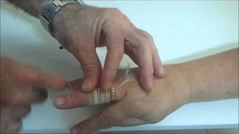 Como tirar um anel que não sai do dedo?