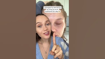 MY BIGGEST SKINCARE MISTAKE! #skincare #skincareroutine #acne #skincaretips #retinol