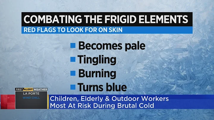 Expert warns what red flags to look for when exposed to extreme cold