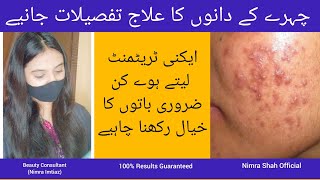 Acne Treatment | Chahre ky Dano ka ilaj | Urdu | Hindi