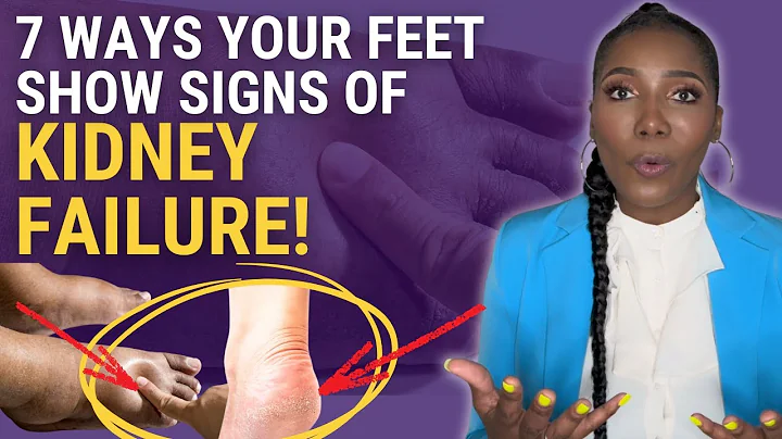 7 TOXIC Signs of Kidney Failure In Your Feet! No. 5 Is SNEAKY!