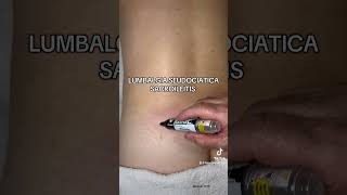 LUMBALGIA, SEUDOCIATICA, SACROILEITIS