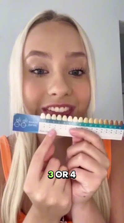 Do you love to smile? Check this out! #teethwhitening #smileconfidence