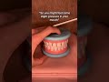 歯の抜歯 Asmr Asmrvideos 満足 歯の抜歯 Asmr Asmrvideos 満足