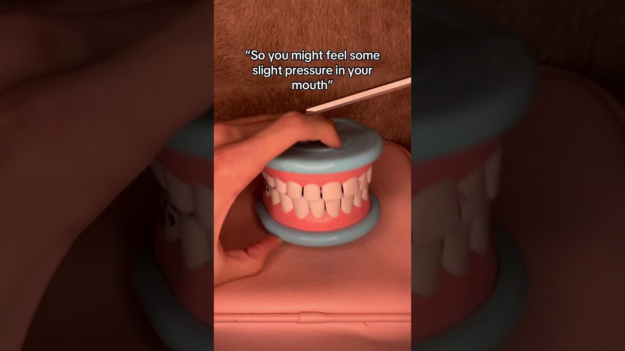 Tooth Removal 