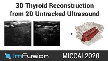 MICCAI 2020 - Three-dimensional thyroid assessment from untracked 2D ultrasound clips