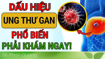 TOP 10 DẤU HIỆU Phổ Biến Báo Hiệu BẠN BỊ UNG THƯ GAN! Dr Phan Quang