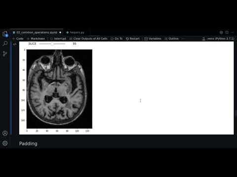 2.2 - Cropping | SimpleITK - Course MRI preprocessing with Python