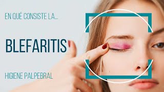 ¿Qué antibiotico es bueno para la blefaritis?