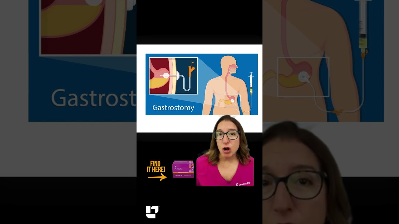 PEG Tube: Nutrition SHORT | 