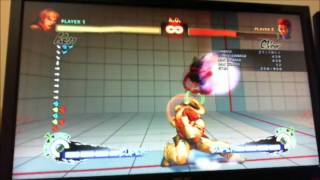Ken Option Selects: Jab DP