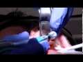Stem-cell Dental Implants Grow New Teeth In Your Mouth