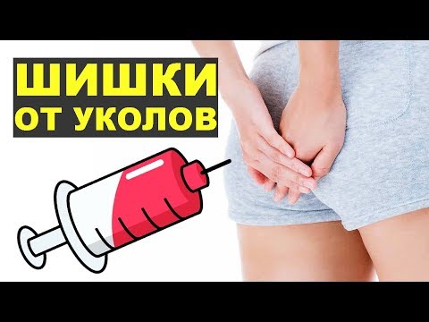 Компрессы от уколов в домашних условиях