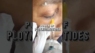 Science Meets Beauty-Polynucleotides Treatment S Unlock Kare Healthy Youthful Glow #undereyecircles