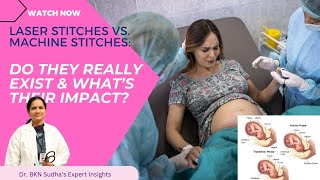 Laser Stitches Vs. Machine Stitches Do They Really Exist Whats Their Impact? - By Dr. Bkn Sudha