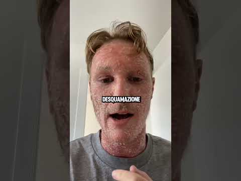 Cosa SUCCEDE a QUESTE MANI?🙌🏻 #fact