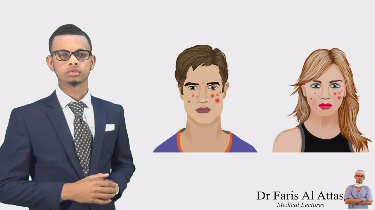 SIDA LOO DAWEEYO FINANKA WAJIGA KU DHACA . Dr faris