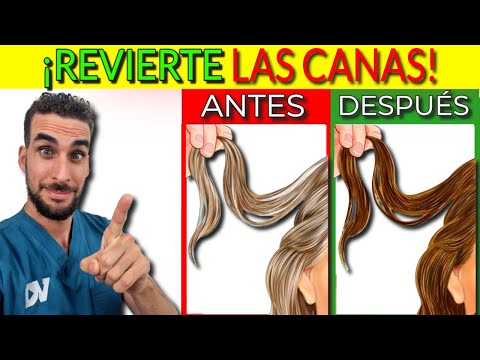 Video: 3 formas de limpiar los poros obstruidos