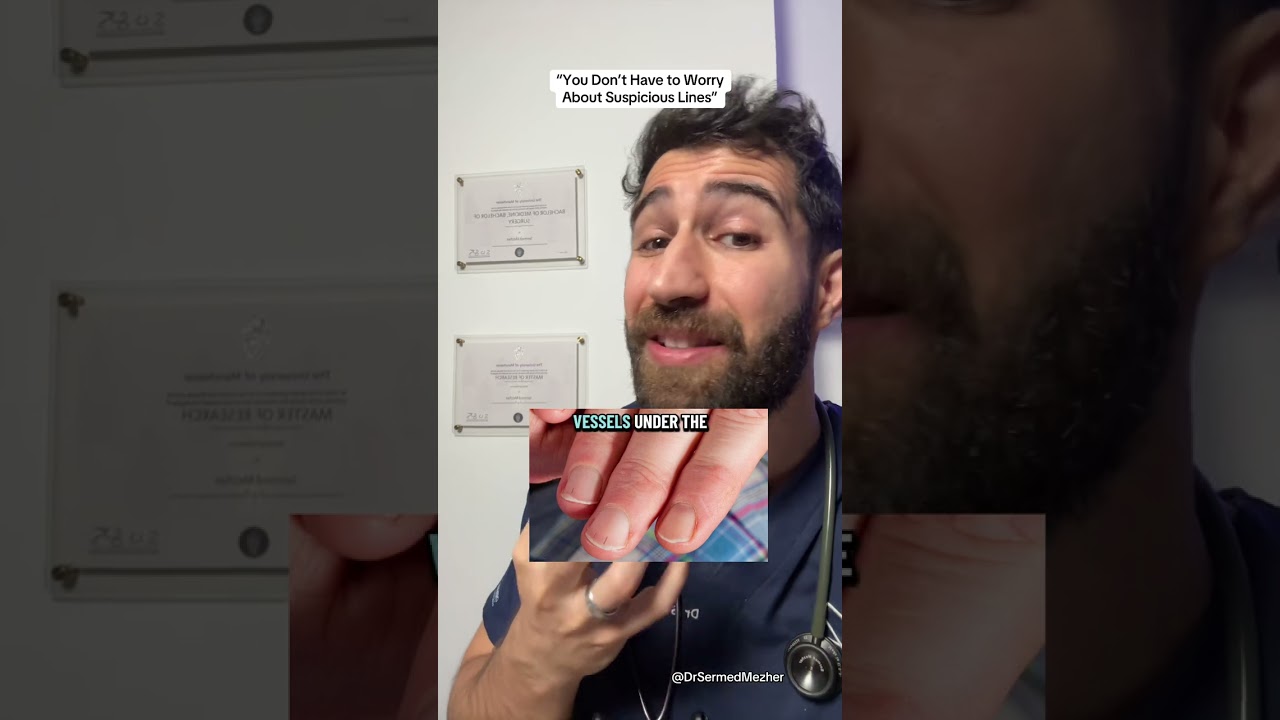 Strange Lines on Your Nails? Doctor Explains