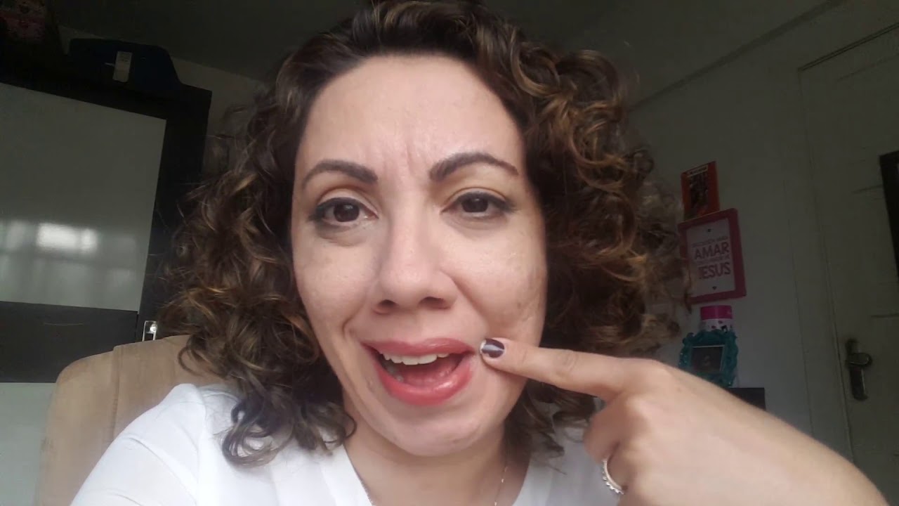 Um ano após a paralisia de bell