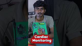 Esp32 cardiac monitoring system  #arduino #arduinoprojects #diyprojects