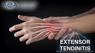 AOA Orthopedic Specialists - Extensor Tendinitis