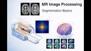 Basics of Segmentation | MR Image Processing #6