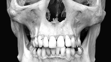 Japanese Synchro System