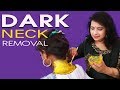 கழுத்தில் உள்ள கருமையை நீக்க சூப்பர் டிப்ஸ்! | Dark Neck Tips