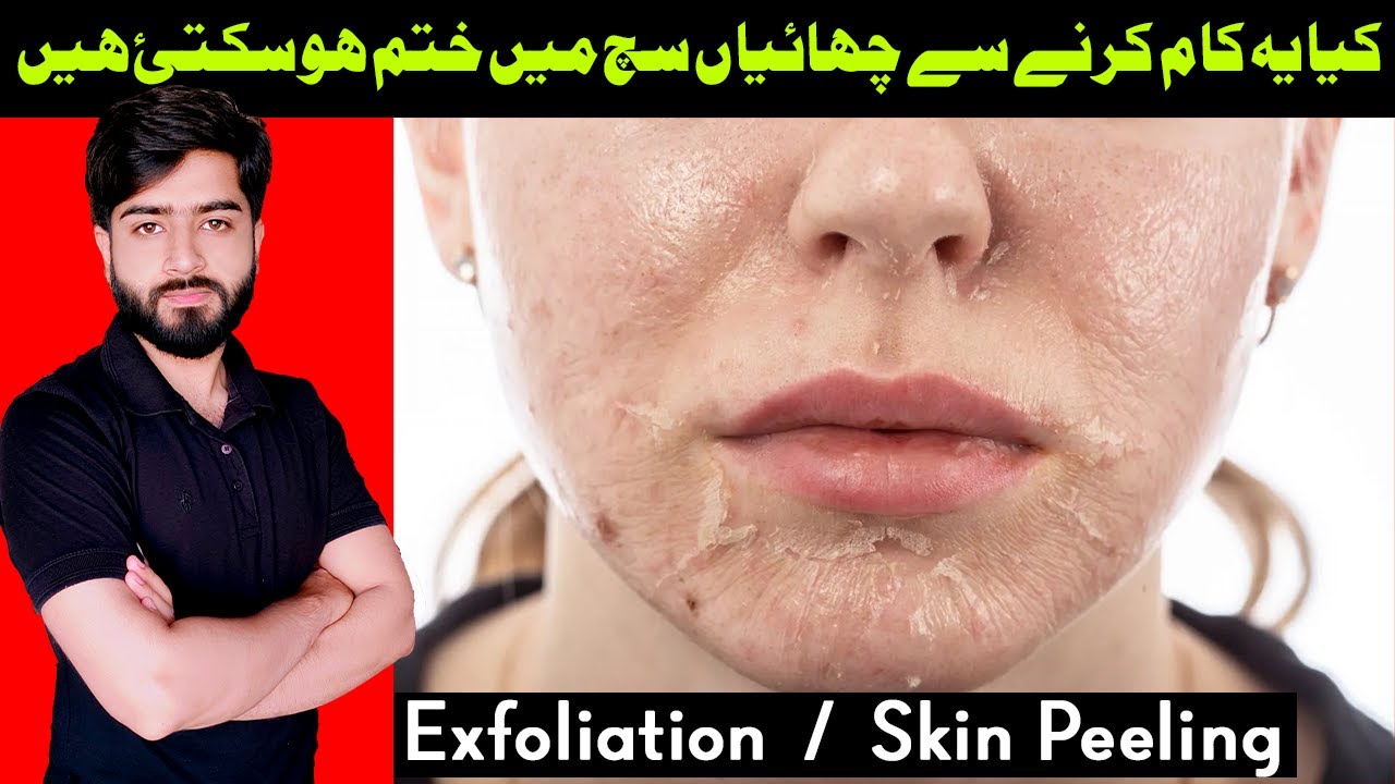 what-is-exfoliation-peel-off-face-skin-scrubing-chemical-peel-off