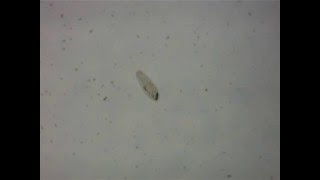 Paramecium Movement (Biol1001 in Sydney Uni) 450178481