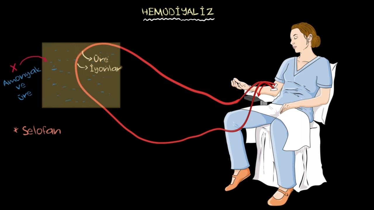 Hemodiyaliz (Sağlık Bilgisi ve Tıp)