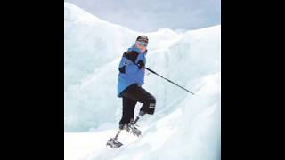 Mark Inglis, Double amputee's feet on Mt. Everest