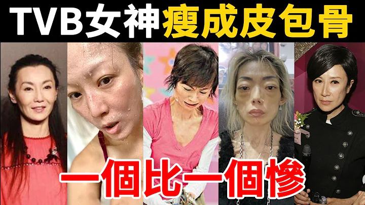 TVB女神瘦成皮包骨！一個被玩弄後染怪病！一個子宮被割險喪命！【星光獎門人】 - 天天要聞