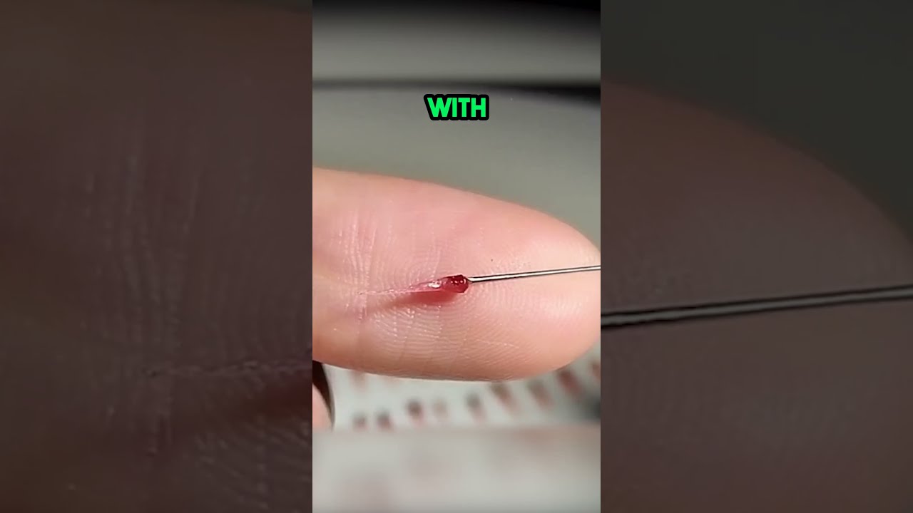 This Is INSANE Berry Surgery 
