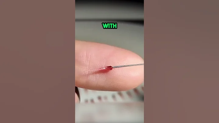 This is INSANE! Berry Surgery! 🤯